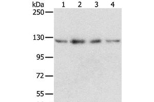 Western Blot analysis of Huvec, hepg2, 293T and A549 cell using RBM5 Polyclonal Antibody at dilution of 1:500 (RBM5 anticorps)