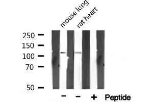 Western blot analysis on various tissue lysate using TAF4 Antibody.