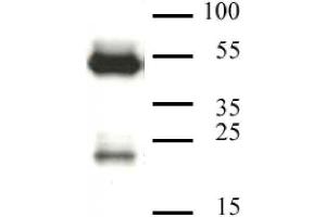 CAF-1 p60 antibody (mAb) tested by Western blot. (CHAF1B anticorps)