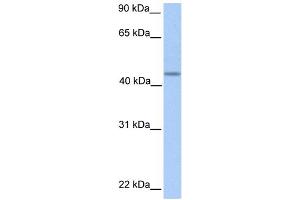 WB Suggested Anti-PNPLA5 Antibody Titration:  0. (PNPLA5 anticorps  (C-Term))