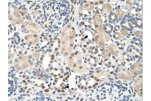 PSAT1 antibody was used for immunohistochemistry at a concentration of 4-8 ug/ml.