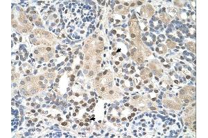 PSAT1 antibody was used for immunohistochemistry at a concentration of 4-8 ug/ml. (PSAT1 anticorps  (N-Term))