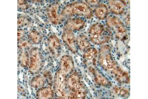 Used in DAB staining on fromalin fixed paraffin- embedded kidney tissue