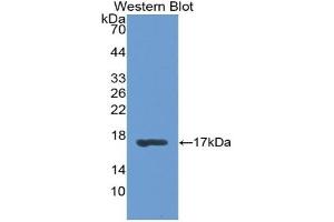 Detection of Recombinant RBP1, Rat using Polyclonal Antibody to Retinol Binding Protein 1, Cellular (RBP1) (RBP1 anticorps  (AA 2-135))
