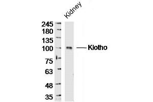 Mouse kidney lysates probed with Klotho Polyclonal Antibody, unconjugated  at 1:300 overnight at 4°C followed by a conjugated secondary antibody at 1:10000 for 90 minutes at 37°C.