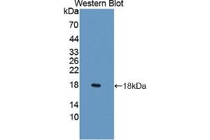 Detection of Recombinant LCNL1, Rat using Polyclonal Antibody to Lipocalin Like Protein 1 (LCNL1) (LCNL1 anticorps)