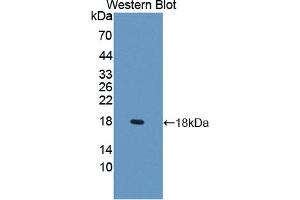 Detection of Recombinant LCNL1, Rat using Polyclonal Antibody to Lipocalin Like Protein 1 (LCNL1) (LCNL1 anticorps)