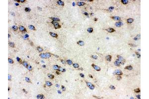 IHC analysis of TCP1 delta using anti-TCP1 delta antibody .