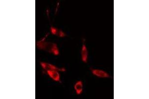 ABIN6275465 staining HeLa cells by IF/ICC. (RAB31 anticorps  (Internal Region))
