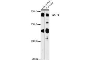 Western blot analysis of extracts of various cell lines, using VEGFR1 antibody (ABIN1683256, ABIN3015026, ABIN3015027 and ABIN6213602) at 1:1000 dilution. (FLT1 anticorps  (AA 1100-1200))
