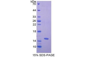 SDS-PAGE analysis of Human Nephrin Protein. (Nephrin Protéine)
