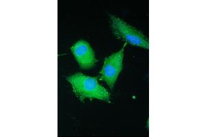 IF analysis of PARN using anti-PARN antibody (ABIN5693032).