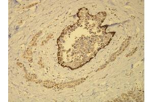 Immunohistochemistry (IHC) image for anti-Keratin 14 (KRT14) (AA 455-471), (C-Term) antibody (ABIN870555) (KRT14 anticorps  (C-Term))