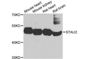 Western blot analysis of extracts of various cell lines, using STAU2 antibody. (Double-stranded RNA-binding protein Staufen homolog 2 (STAU2) (AA 300-400) anticorps)