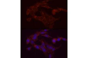 Immunofluorescence analysis of PC-12 cells using DG Rabbit pAb (ABIN6134325, ABIN6139556, ABIN6139557 and ABIN6222582) at dilution of 1:200 (40x lens). (DGAT1 anticorps  (AA 200-300))