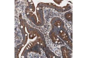 Immunohistochemical staining of human duodenum with CTTNBP2NL polyclonal antibody  shows strong cytoplasmic positivity in glandular cells. (CTTNBP2NL anticorps)