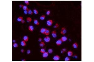 IF analysis of IL15RA using anti-IL15RA antibody (ABIN5519011).