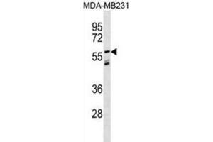 Western Blotting (WB) image for anti-Leucine-Rich Repeat LGI Family, Member 3 (LGI3) antibody (ABIN3000958) (LGI3 anticorps)