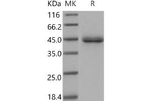 Western Blotting (WB) image for Surfactant Protein D (SFTPD) protein (His tag) (ABIN7320367)