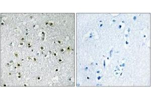 Immunohistochemistry analysis of paraffin-embedded human brain tissue, using TFE3 Antibody.