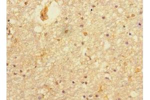 Immunohistochemistry of paraffin-embedded human brain tissue using ABIN7165067 at dilution of 1:100 (PRMT3 anticorps  (AA 311-529))