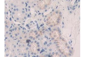 Used in DAB staining on fromalin fixed paraffin- embedded kidney tissue (CTSA anticorps  (AA 215-470))