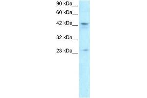 ZNF365 antibody used at 1. (ZNF365 anticorps  (N-Term))