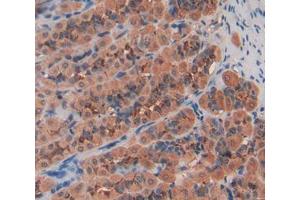 Used in DAB staining on fromalin fixed paraffin- embedded stomach tissue