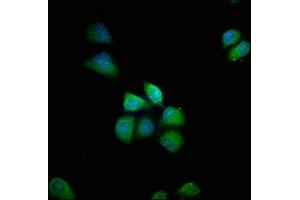 Immunofluorescence staining of Hela cells with ABIN7155168 at 1:66, counter-stained with DAPI. (PDE8B anticorps  (AA 18-110))