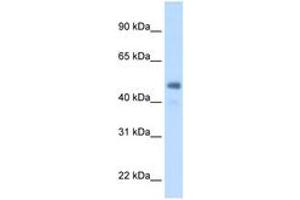 Image no. 1 for anti-Fibrinogen gamma Chain (FGG) (AA 301-350) antibody (ABIN205040) (FGG anticorps  (AA 301-350))