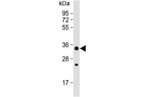 CHIP / STUB1 antibody western blot analysis in MCF7 lysate. (STUB1 anticorps  (AA 203-231))