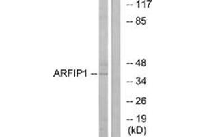 Western blot analysis of extracts from Jurkat cells, using ARFIP1 Antibody. (ARFIP1 anticorps  (AA 271-320))