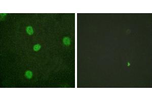 P-peptide - +Western blot analysis of extracts from K562 cells, using B-Myb (Phospho-Ser577/581) antibody. (MYBL2 anticorps  (pSer577, pSer581))