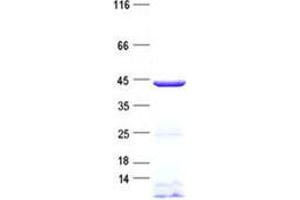Validation with Western Blot (Dnmt2 Protein (His tag))