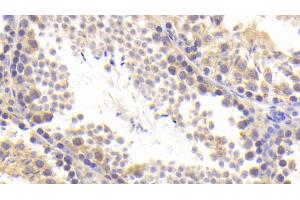Detection of BACE2 in Mouse Testis Tissue using Polyclonal Antibody to Beta Secretase 2 (BACE2)