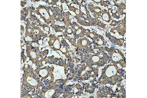 IHC analysis of AGR2 using anti-AGR2 antibody (ABIN5518726). (AGR2 anticorps  (AA 21-175))