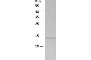Interleukin 25 (IL25) (AA 33-177) protein (His tag)