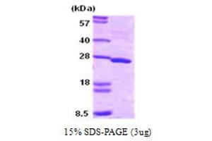 SDS-PAGE (SDS) image for Synaptosomal-Associated Protein, 25kDa (SNAP25) (AA 1-206) protein (ABIN667078)