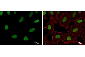ICC/IF Image RecQ1 antibody [N1N2], N-term detects RecQ1 protein at nucleus by immunofluorescent analysis.