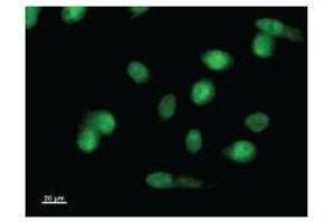 Immunostaining analysis in HeLa cells. (LMO1 anticorps)