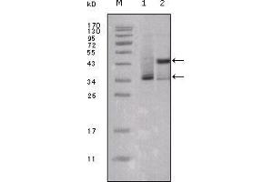 Western blot analysis using ESR1 mouse mAb against truncated ESR1-His recombinant protein (1) and truncated Trx-ESR1 recombinant protein (2). (Estrogen Receptor alpha anticorps  (AA 301-595))