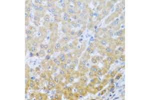 Immunohistochemistry of paraffin-embedded human liver using IL20 antibody at dilution of 1:100 (40x lens). (IL-20 anticorps)