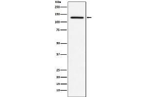 Western blot analysis of MDA5 expression in THP1 cell lysate.