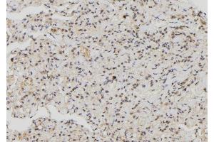 ABIN6276875 at 1/100 staining Human lung tissue by IHC-P. (MX1 anticorps  (C-Term))