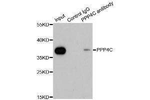 Immunoprecipitation analysis of 200ug extracts of 293T cells using 1ug PPP4C antibody. (PPP4C anticorps  (AA 1-307))