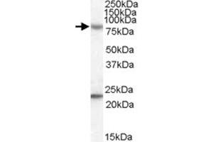 DHX58 polyclonal antibody  (0. (DHX58 anticorps)