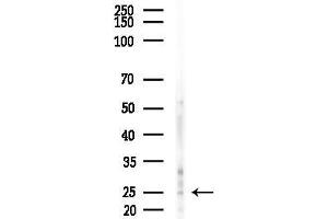 Western blot analysis of lysates from HUVEC cells(starvation,24h treatment), using SCN2B Antibody at 1/1000 dilution.