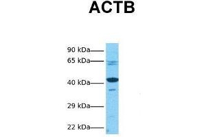 Host:  Rabbit  Target Name:  ACTB  Sample Tissue:  Human HepG2  Antibody Dilution:  1.