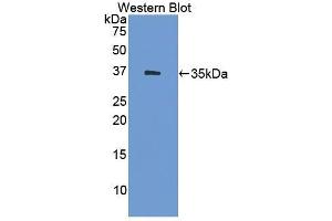 Detection of Recombinant HSD17b1, Human using Polyclonal Antibody to 17-Beta-Hydroxysteroid Dehydrogenase Type 1 (HSD17b1) (HSD17B1 anticorps  (AA 4-289))