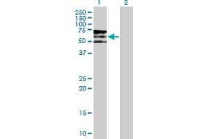 Western Blot analysis of PIP5K3 expression in transfected 293T cell line by PIP5K3 MaxPab polyclonal antibody. (PIKFYVE anticorps  (AA 1-451))